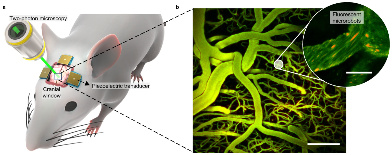 Ultrasound microrobots guide medications to treat brain tumors, other conditions