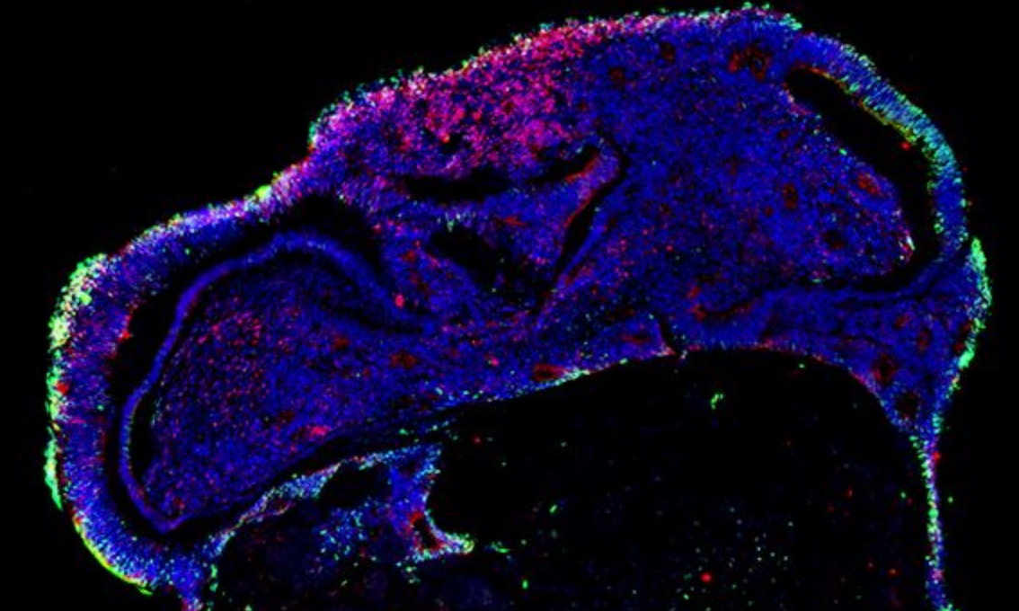 Game-changing organoid model to study human cerebellar development and disease