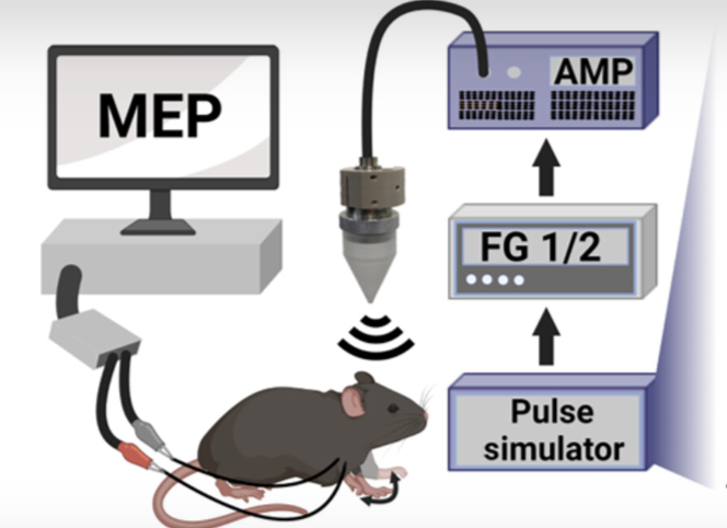 Ultrasound brain stimulation technique treats brain disorders more deeply and safely