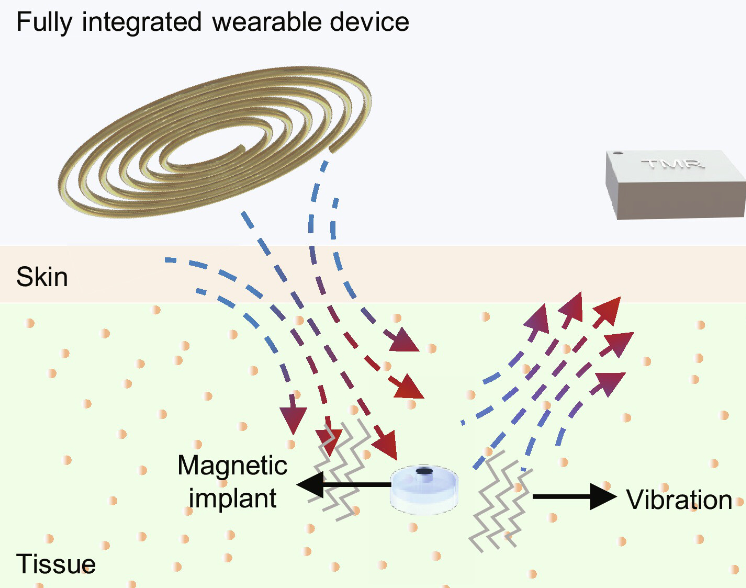 Tiny magnetic sensor enables wireless health monitoring