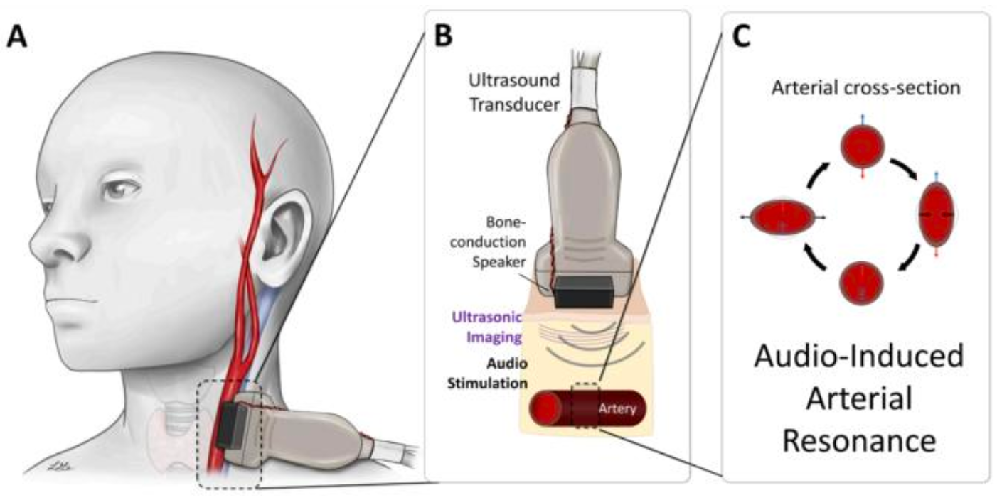 Wearable blood pressure monitor uses ultrasound to capture a continuous record of blood pressure