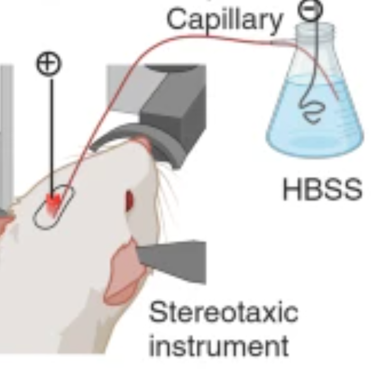 New, more accurate way to deliver medicine to the brain