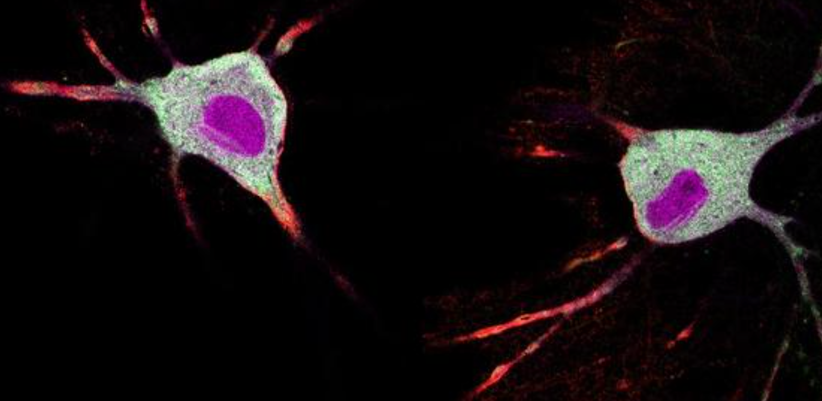 Tracking how psychedelics affect neurons