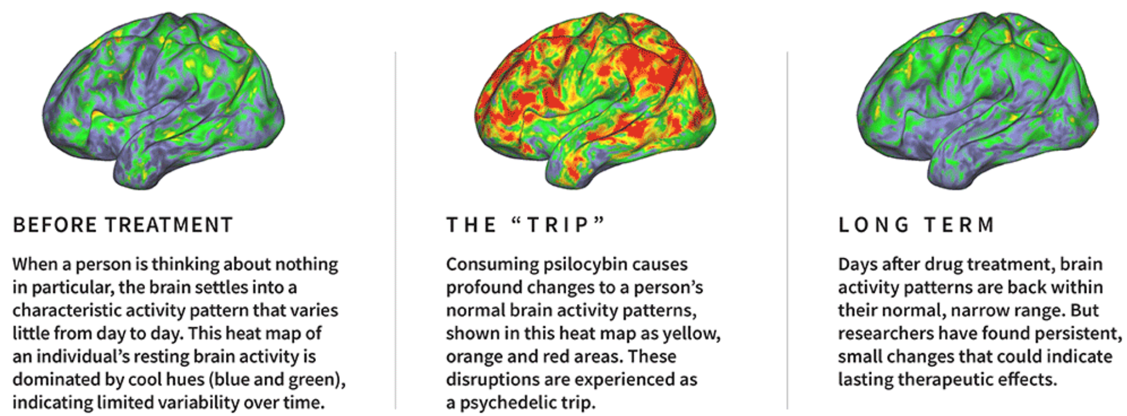 Psilocybin generates psychedelic experience by disrupting brain network