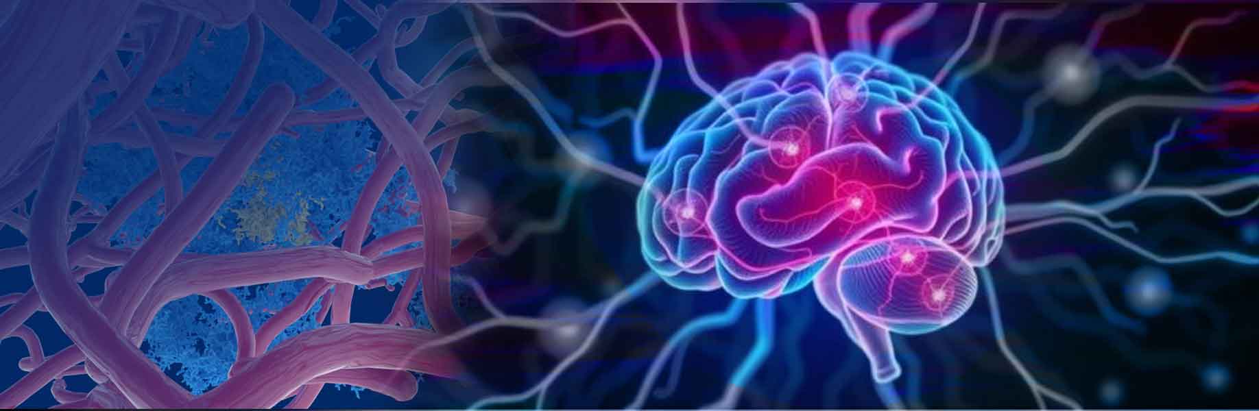 Open Brain Institute launches digital brain research program